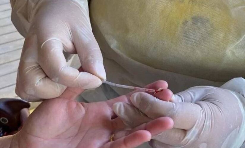 A paciente deu entrada no hospital em estado grave e, pelos sintomas apresentados, ficou claro para eles que se tratava de uma doença no fígado