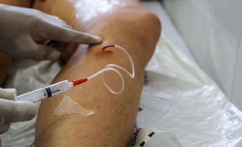 A doença é mais comum em pessoas idosas, obesas, sedentárias, fumantes, além das que possuem casos da comorbidade entre familiares e também em pacientes que ficaram muito tempo acamados devido a algum trauma. 