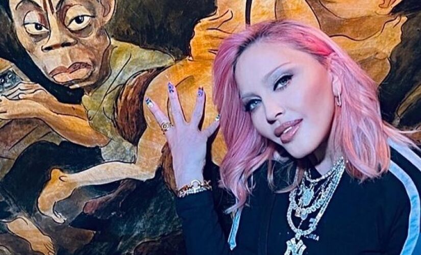Madonna após fazer cirurgias plásticas.