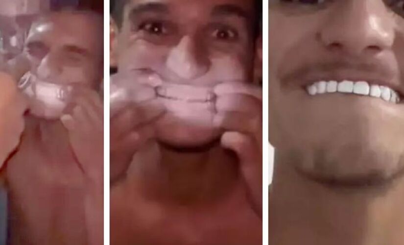 Em suas redes sociais, um jovem gravou um método que supostamente clareia os dentes, o método e ganhou notoriedade por usar tinta branca de parede mas segundo dentista o procedimento é perigoso e ineficaz