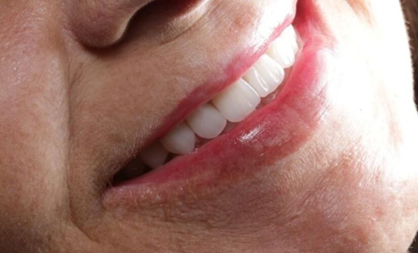 Um sorriso bonito e saudável ajuda a elevar a autoestima e, além disso, traz benefícios para a saúde