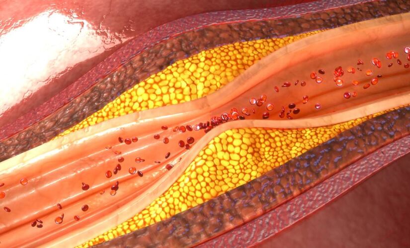 Quatro entre 10 brasileiros adultos apresentam níveis alterados de colesterol