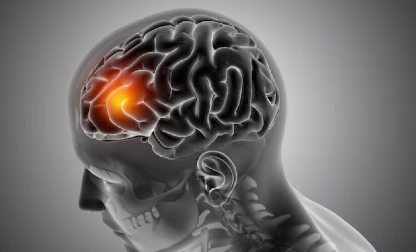 Mês de maio também é conhecido como 'Maio Vermelho', para conscientizar sobre o Acidente Vascular Cerebral (AVC)