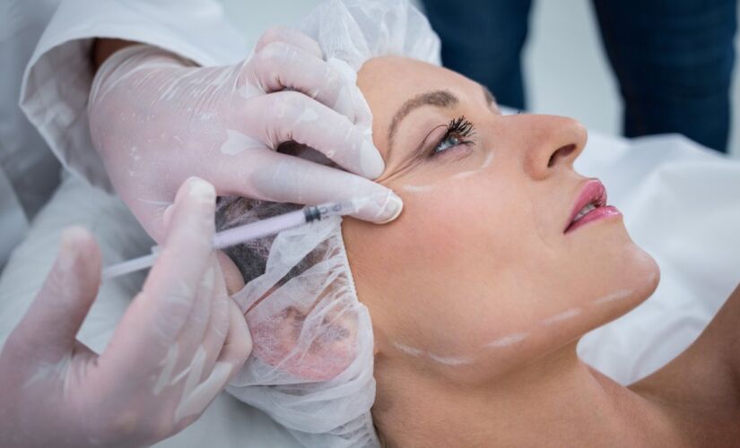 Os bioestimuladores de colágeno servem para rejuvenescer a pele