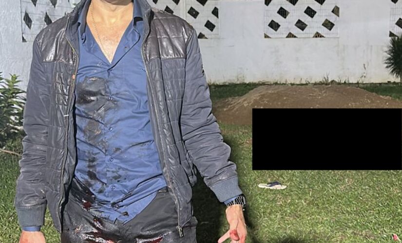 Policial disparou contra invasor em sua casa em Caraguatatuba