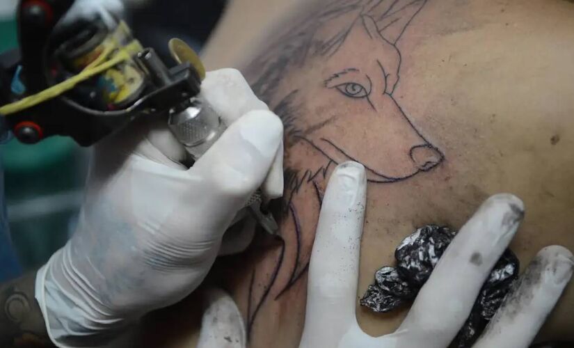 Proibição ocorre tanto para anestesia tópica (local) quanto para geral e a sedação para o procedimento