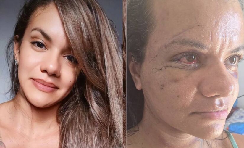 Juliana foi agredida de forma brutal pelo namorado dentro do elevador do prédio onde mora em Ponta Negra