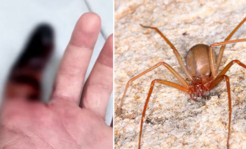 Muito comum em casas brasileiras, a aranha marrom pode até causar perda de membros, como dedos