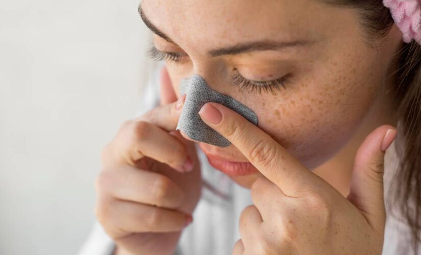 Receitas fáceis e rápidas para remover cravos em casa