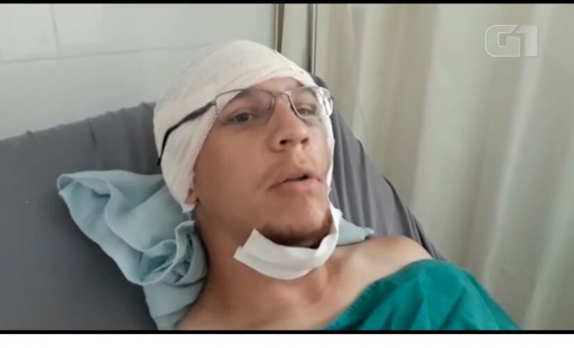 O surfista Vinícius Cavalcanti, de 31 anos, morador do local, foi mordido no rosto enquanto surfava na praia Cacimba do Padre