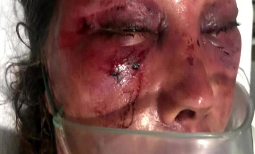 Elaine Caparróz, de 55 anos foi espancada durante quatro horas pelo advogado Vinícius Batista Serra, de 27 anos, em 1º encontro