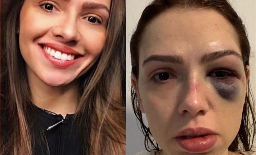  A vendedora Tatiany Arci, de 31 anos, agredida em balada em SP