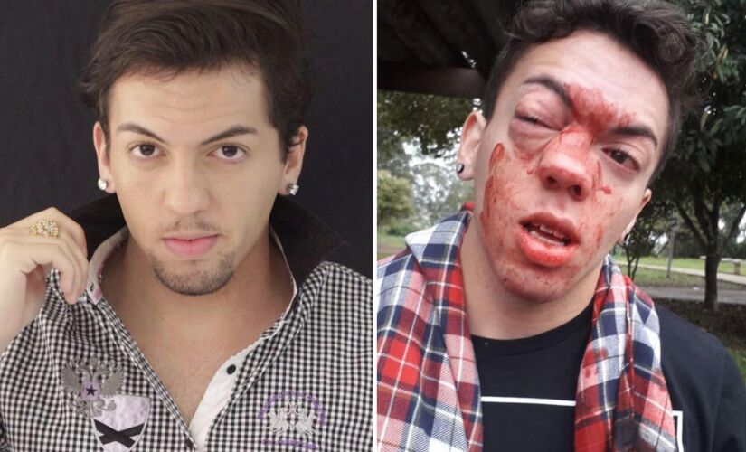 Ator Marcello Santanna diz que foi agredido por motorista de ônibus e denuncia homofobia na zona leste 