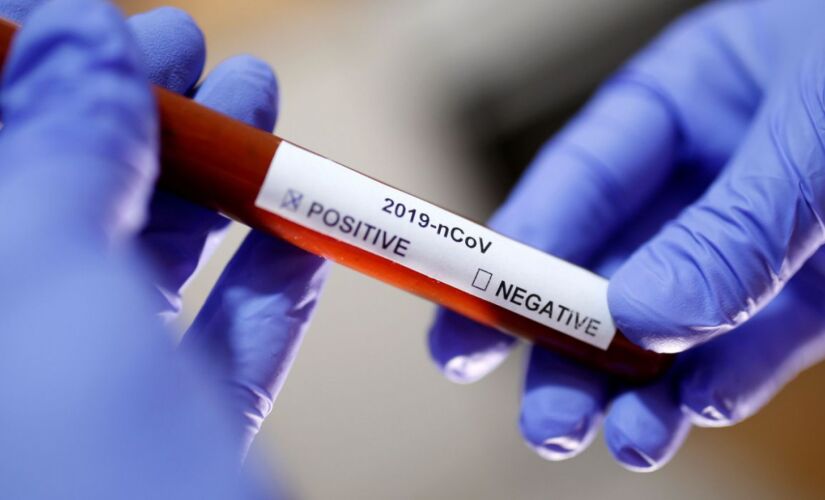 De acordo com a confedera&ccedil;&atilde;o, foram realizados 15.235 testes de infec&ccedil;&atilde;o pelo novo coronav&iacute;rus