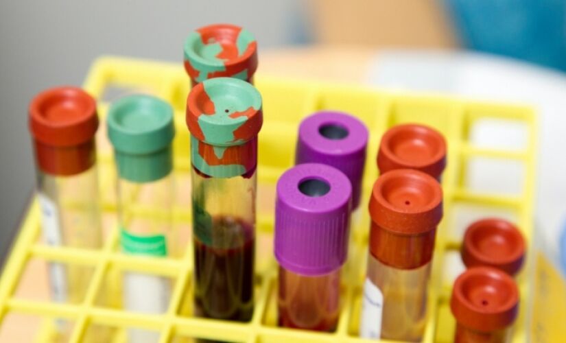 Novo exame de sangue pode ajudar no diagnóstico de Alzheimer