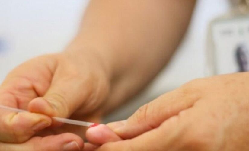 Teste para HIV