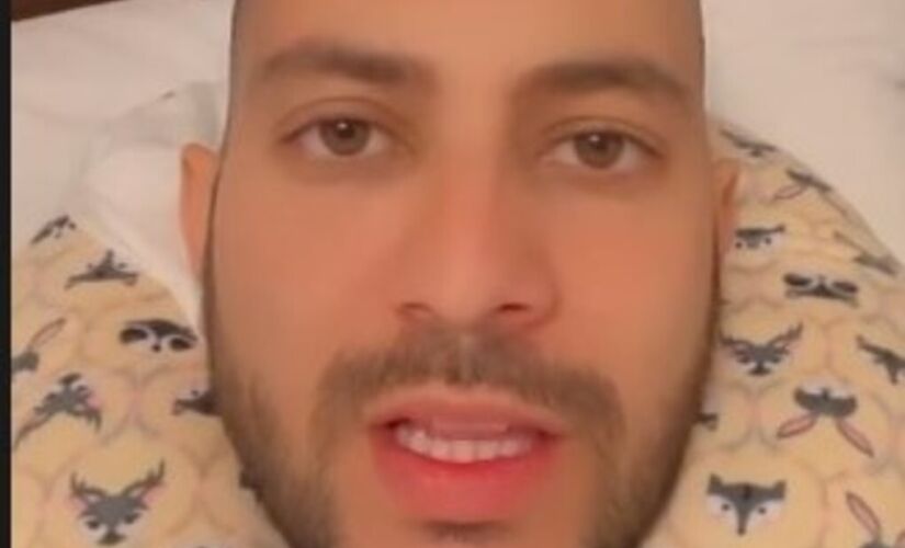Caio Afiune, ex 'BBB 21', apareceu careca ap&oacute;s transplante capilar 