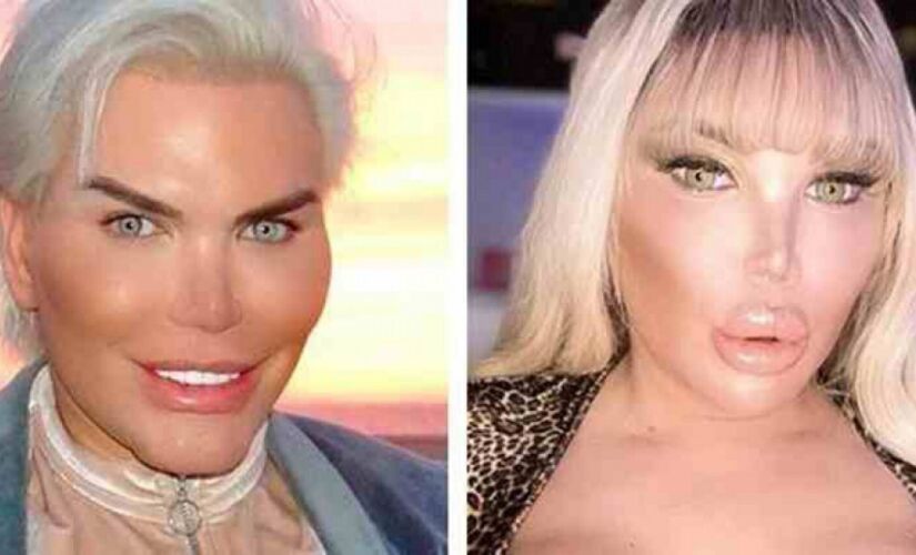 Jessica Alves, 38, que ficou famosa após passar por mais de 70 cirurgias plásticas para se tornar o Ken Humano.