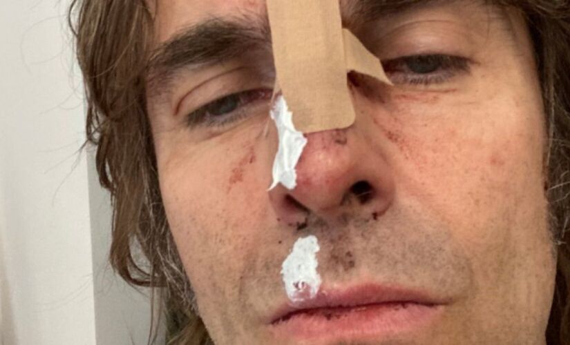 Liam Gallagher 