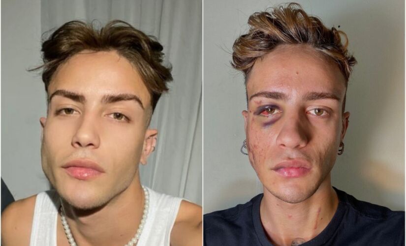 Jovem diz ter sido agredido por médico durante convulsão em hospital de Salto, no interior de SP