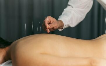 A acupuntura é uma prática milenar desenvolvida na China que consiste na inserção de agulhas em lugares específicos do corpo