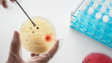 Veja quantas bactérias e quais estão "pegando uma carona" com você