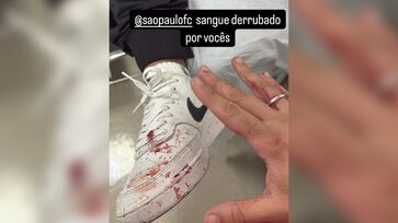 Torcedor acusa o clube de negligência após acidente