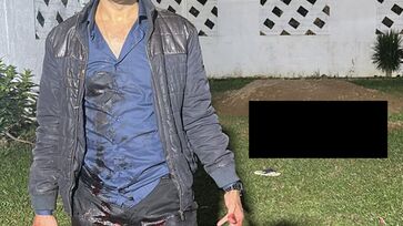 Policial disparou contra invasor em sua casa em Caraguatatuba