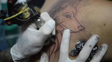 Proibição ocorre tanto para anestesia tópica (local) quanto para geral e a sedação para o procedimento