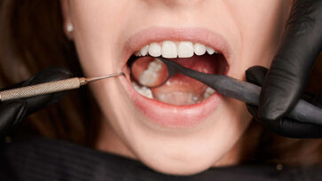 Falta de cuidados com a boca pode levar à perda dentária e até afetar a saúde geral