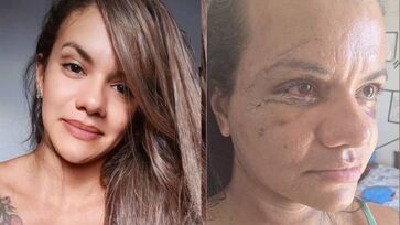 Juliana foi agredida de forma brutal pelo namorado dentro do elevador do prédio onde mora em Ponta Negra