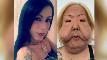 Cirurgia de reparação em 'Juju do Pix' é a primeira de várias