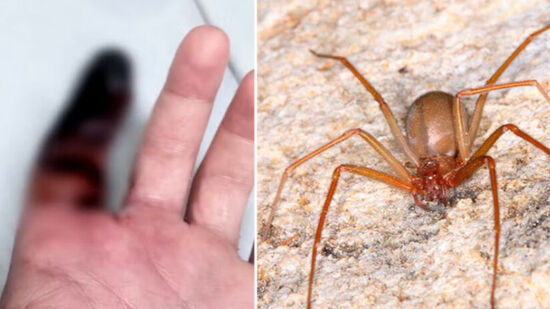 Muito comum em casas brasileiras, a aranha marrom pode até causar perda de membros, como dedos