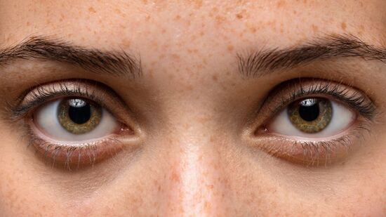 A mioquimia palpebral é comum e geralmente aparece em momentos de estresse ou cansaço