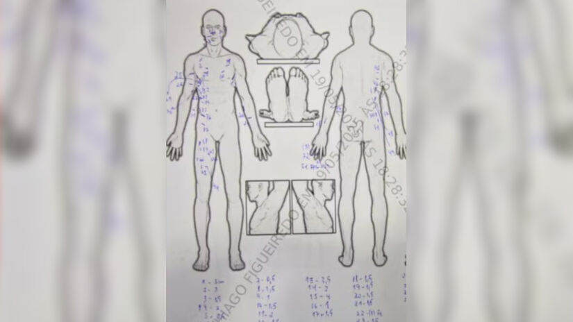 Laudo do Instituto Médico Legal (IML) mostram os locais em que Amanda recebeu diversas facadas. 