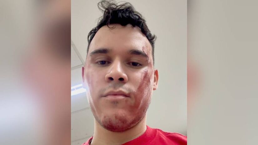 Alexandre Edward disse que só conseguiu atendimento para os familiares após invadir o gramado para pedir ajuda e que o atendimento ocorreu somente após o término da partida.
Reprodução/Instagram