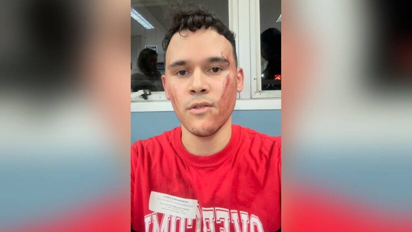 "Tive que manchar a cara com o sangue do meu pai, para pedir socorro", disse Alexandre Edward.
Reprodução/Instagram