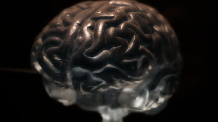 Baixa inteligência pode estar associada a problemas no desenvolvimento cerebral. Imagem: PxHere