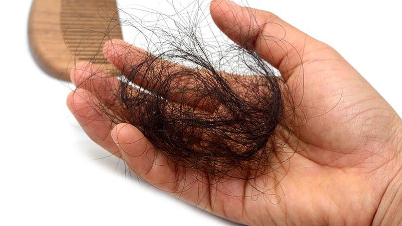 Soludão pode gerar queda de cabelo. Imagem: Wendy Burchfield/Flickr