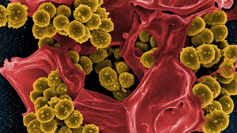 Bactéria F. prausnitzii habita o intestino humano. Imagem: Domínio Público