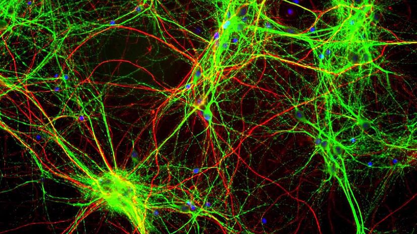 O óleo de CBD pode diminuir a inflamação das células neurais causadas pelo Alzheimer. Imagem: GerryShaw/Wikimedia Commons
