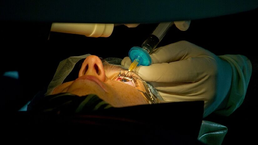 Cirurgias LASIK envolvem literalmente remover pedaços da córnea. Imagem: Peretz Partensky/Wikimedia Commons