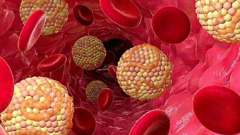 lipoproteína de baixa densidade (LDL) é conhecida como "colesterol ruim". Imagem: TLECOATL ZYANYA/Wikimedia Commons