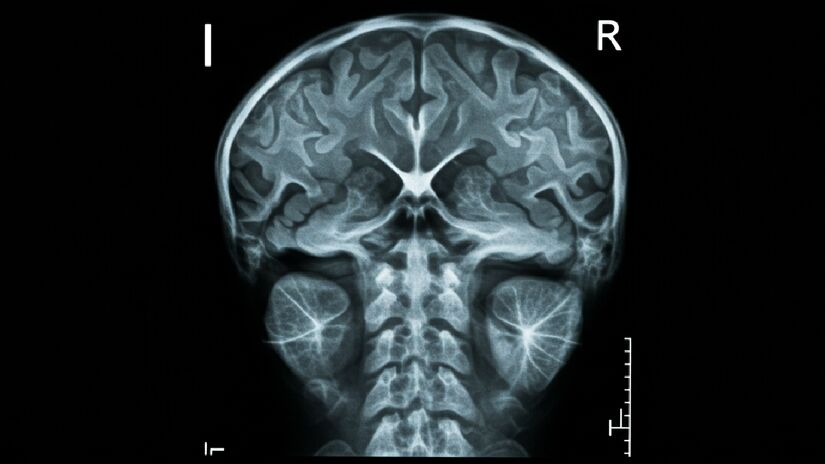 Um sistema cardiovascular saudável também promove a saúde cerebral. Imagem gerada por inteligência artificial 