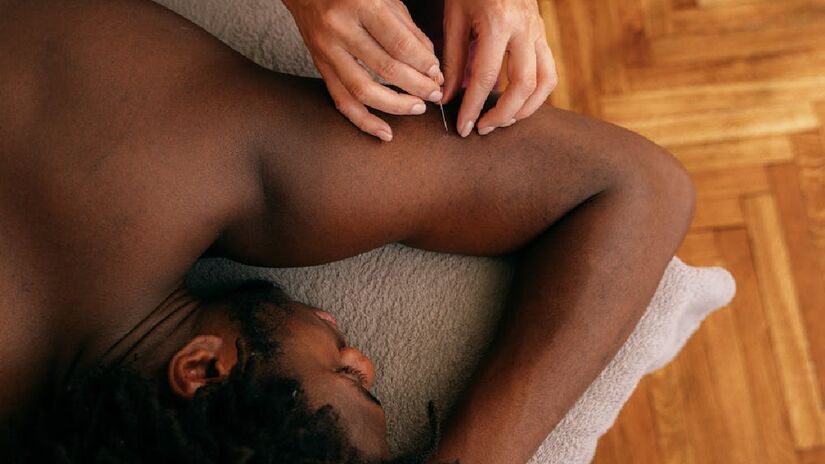 Médicos reforçam que a acupuntura deve ser utilizada como parte de um plano terapêutico, sempre consequente ao diagnóstico médico - (Antoni Shkraba Studio/Pexels)