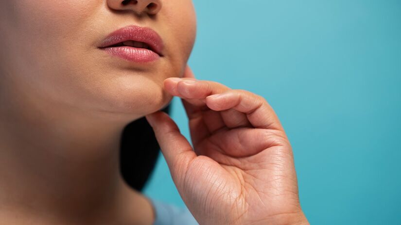 Exercícios, alimentação equilibrada e tratamentos dermatológicos podem reduzir a papada e melhorar o contorno facial