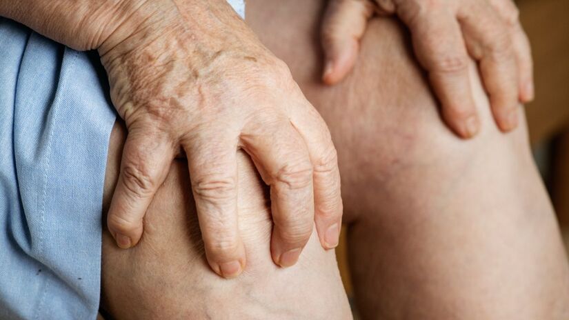 Um edema é um inchaço no corpo causado pelo acúmulo excessivo de líquido nos tecidos, que pode ocorrer em qualquer parte do corpo e ser generalizado ou localizado. Esse inchaço, associado à retenção de líquidos, não desaparece após o repouso. 