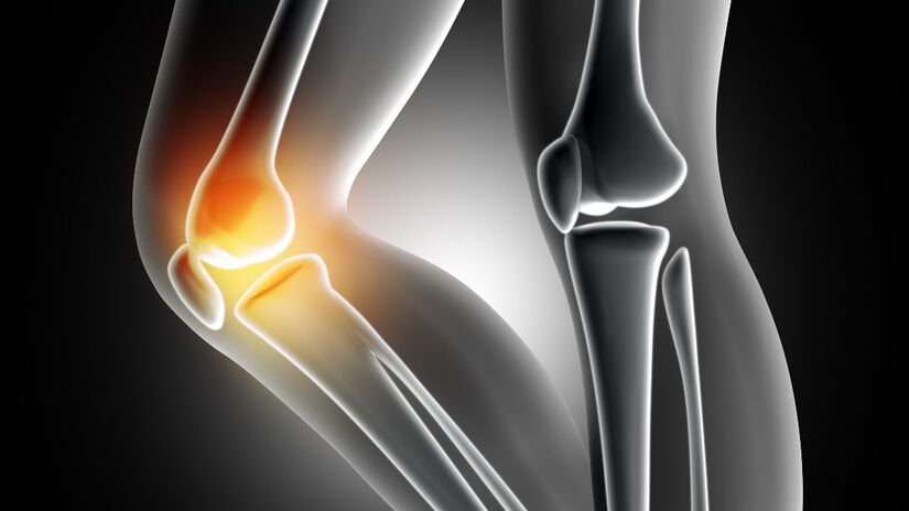 Diferente dos implantes convencionais, o material se integra ao organismo, combate infecções e se degrada gradualmente, sendo substituído por tecido ósseo natural