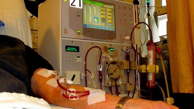 Pacientes com falência renal podem precisar fazer diálise, procedimento que purifica o sangue fora do corpo. Imagem: Anna Frodesiak/Wikimedia Commons