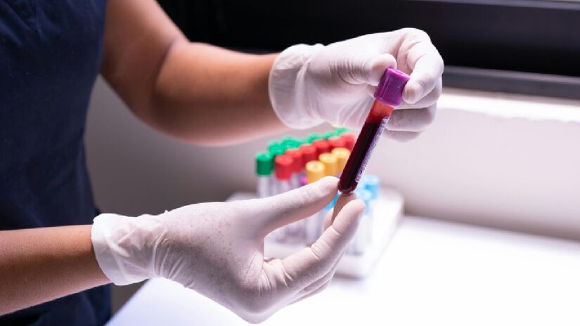 Exames de sangue podem mostrar seu nível de diabetes e colesterol. Imagem: Pexels